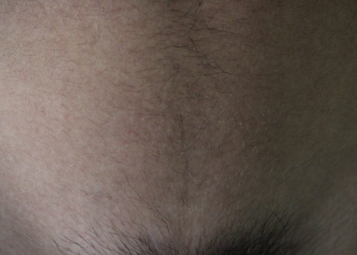 5 5